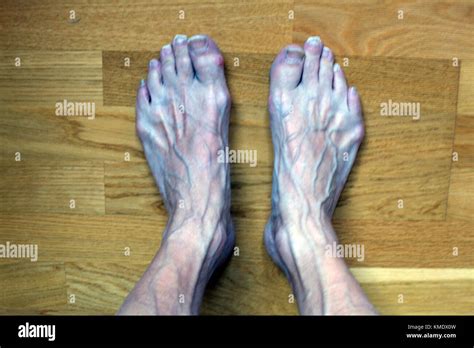 ugly feet pics|Ugly Feet Pics for Sale 